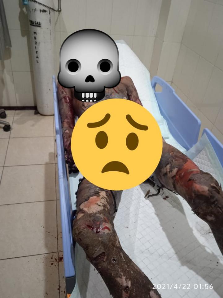 Dhuaarrrr!!! Sedang Racik Mercon, Meledak, Meninggal Dunia
